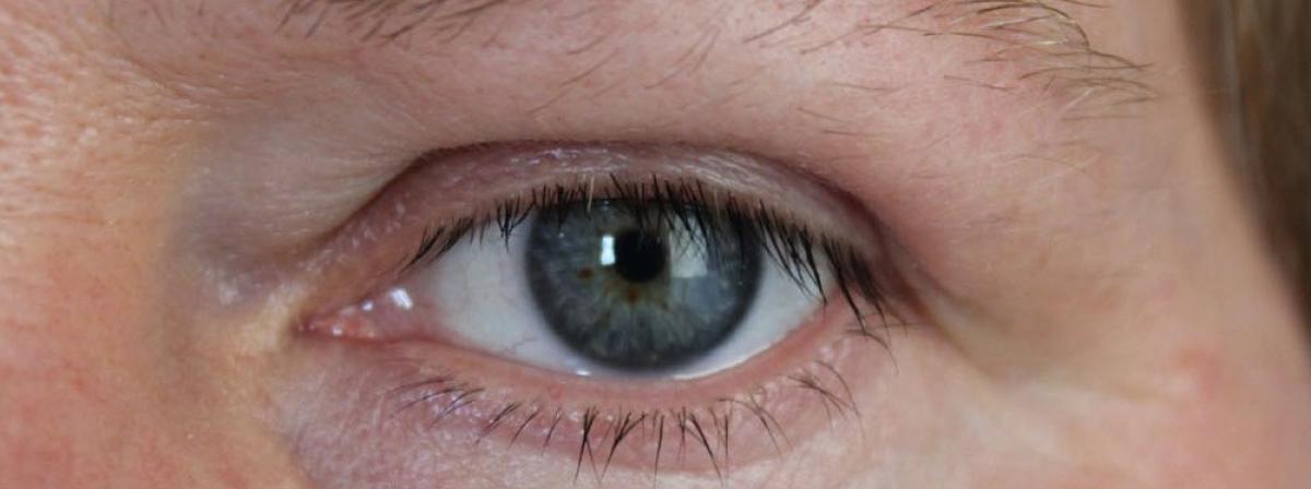 Augenlidklebeband Tipps und Vergleich
